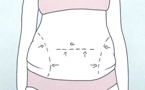 腹部拉皮和腹壁整形有何不同？适应人群、疤痕位置、恢复时间一文搞懂