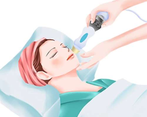 激光祛雀斑效果怎么样？真实体验大揭秘，内附避坑干货