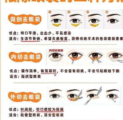 去眼袋