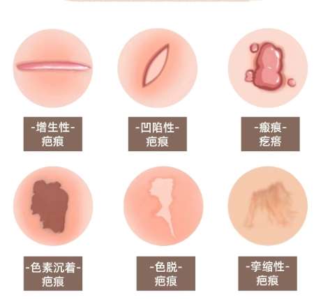 八大处臧梦青手术案例图展示！面诊技巧附上！来看前后差别