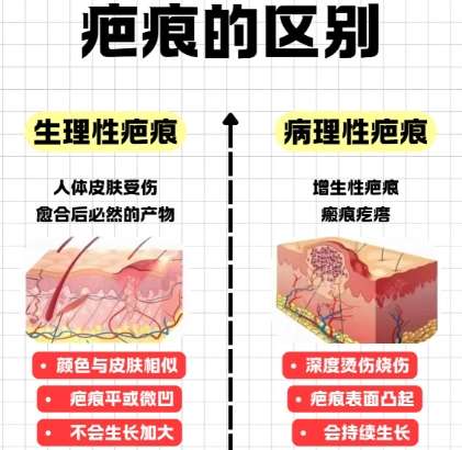 祛疤