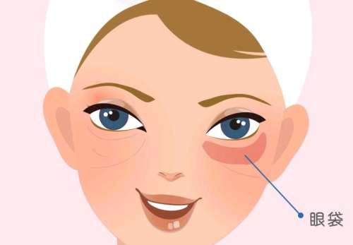 眼袋