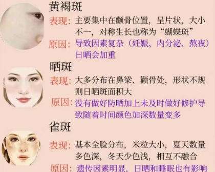 祛斑