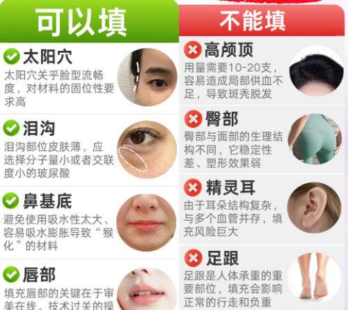 上海第九整形美容医院脂肪填充效果怎么样？医院资质-实力-价格一文了解！