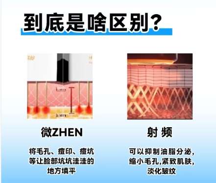 光子嫩肤 光子嫩肤