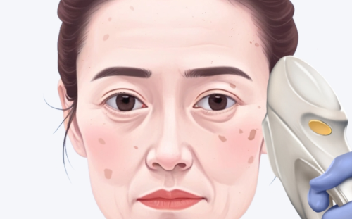 北京八大处热玛吉是哪位医生做得好？擅长部位和价格段整理