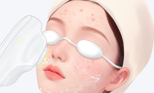 北京301医院点阵激光多少钱？痘坑痘印毛孔项目价格简单对照