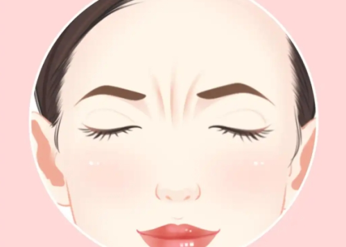 去川字纹的好方法有哪些？注射、仪器和联合方案怎么选