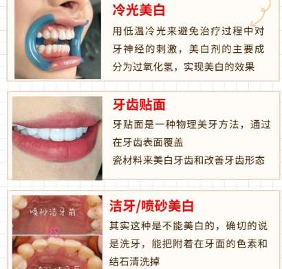 牙齿美白