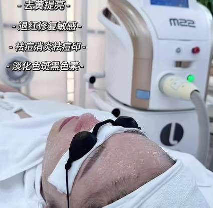 光子嫩肤 光子嫩肤