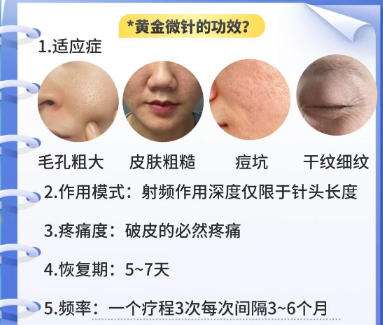 黄金微针 黄金微针