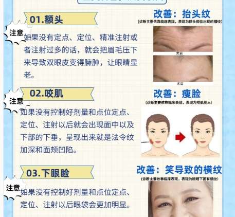 注射美容 注射美容