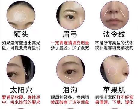 面部填充 面部填充