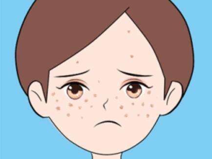 激光点痣多久能恢复正常？普通人必看的真实恢复时间表