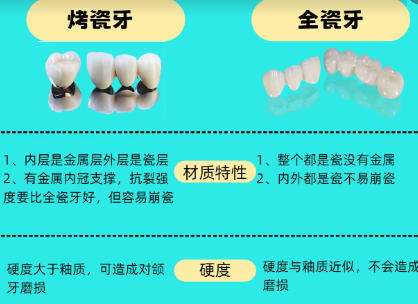 烤瓷牙