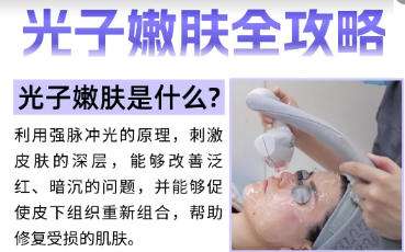光子嫩肤