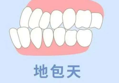 成人地包天手术.jpg