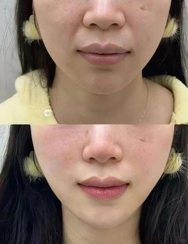 垂感让脸显得疲惫_1_小红薯6A2A7CBF_来自小红书网页版.jpg