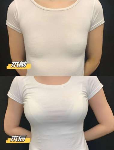 胸.jpg